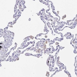 Fc gamma RIIIA/CD16a Antibody, Novus Biologicals:Antibodies:Primary Antibodies